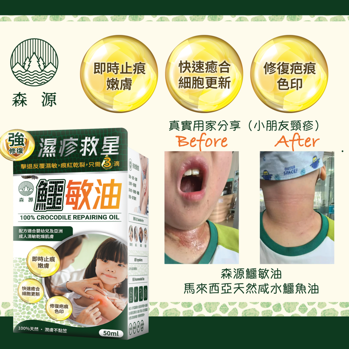 森源 鱷敏油