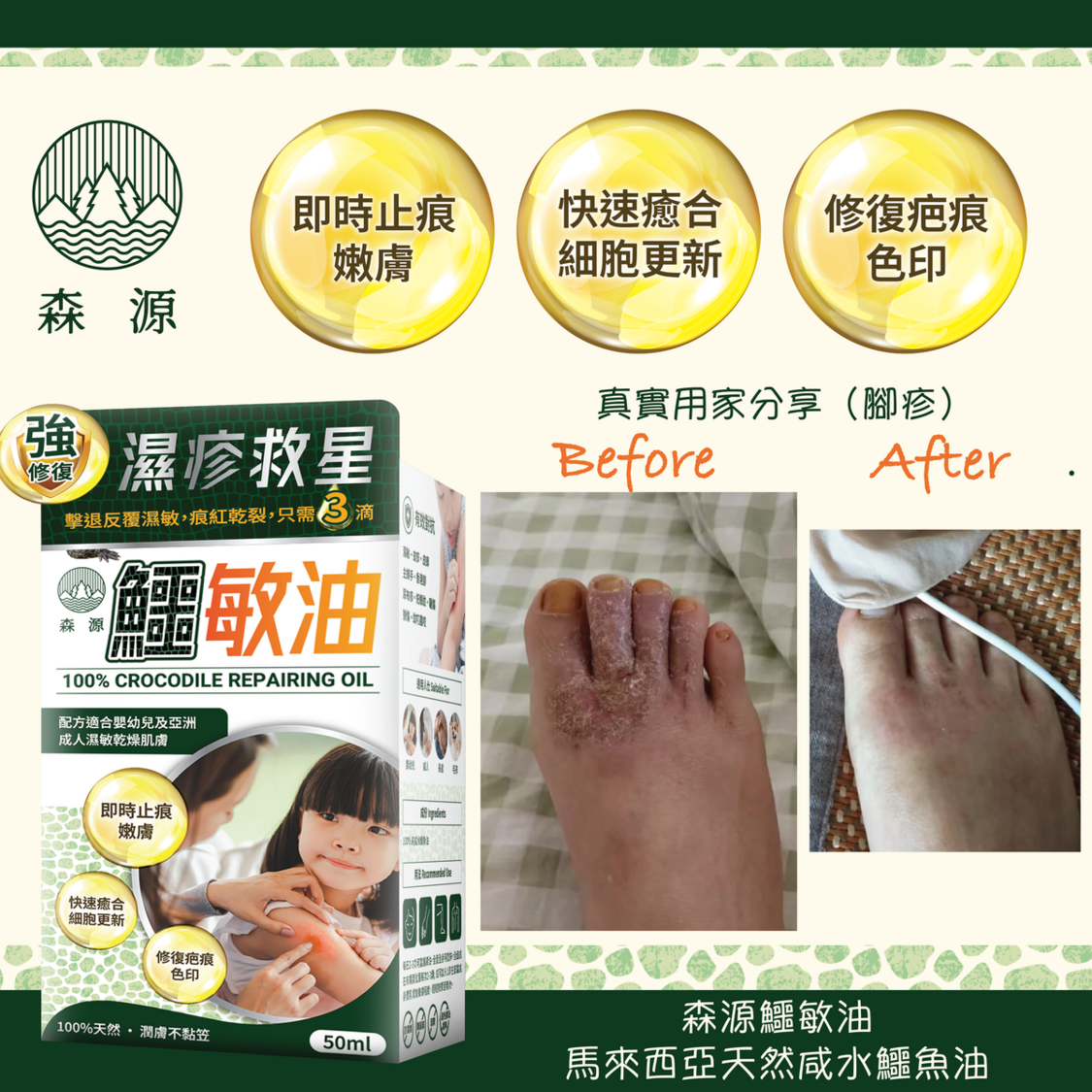 森源 鱷敏油